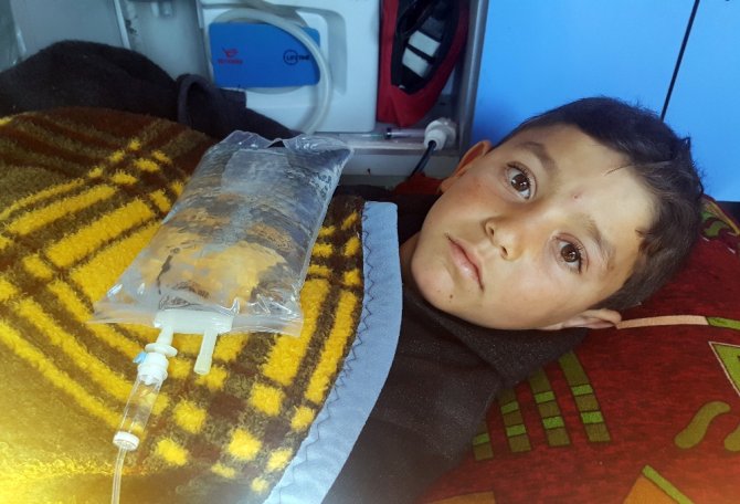 Suriye’de Bacakları Kopan Çocuk Türkiye’ye Getirildi