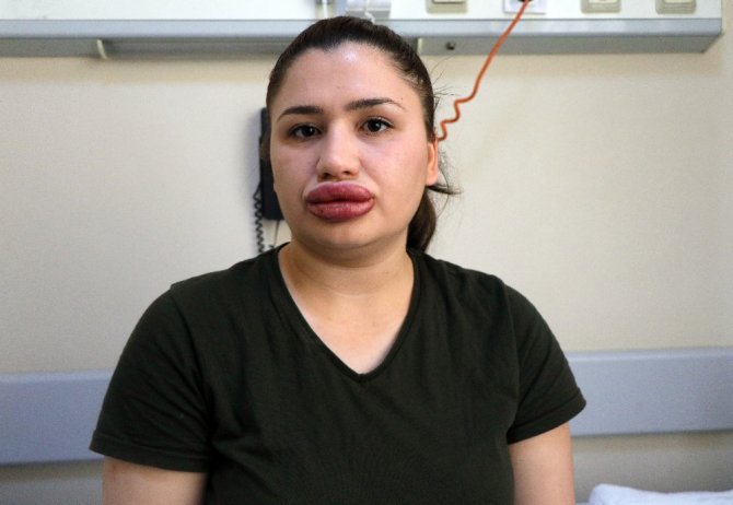 Slikon Mağduru Hemşire Konuştu: Çok Korkuyorum