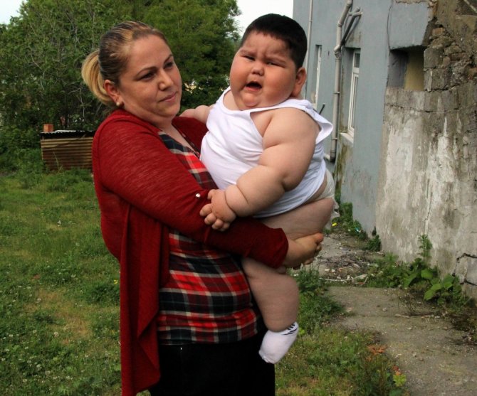 1,5 Yaşında 32 Kilo