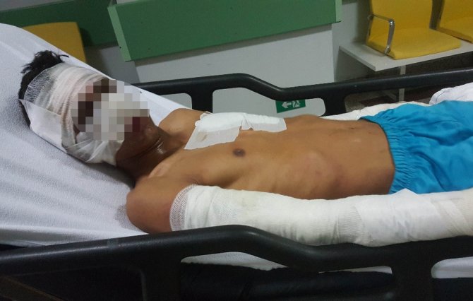 Çakmak Gazı Dehşeti: 4 Çocuk Yaralı
