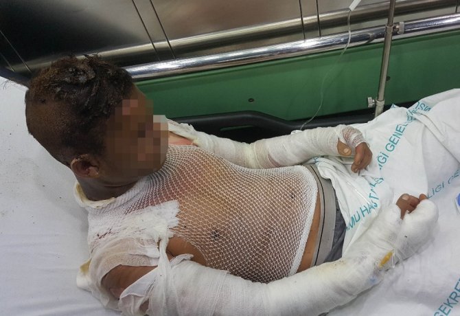 Çakmak Gazı Dehşeti: 4 Çocuk Yaralı
