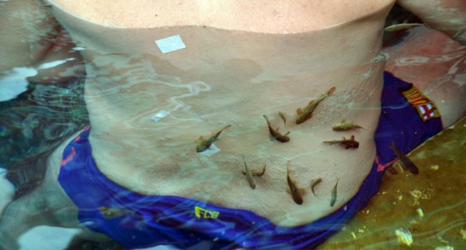 Doktor Balıkların Sırrı Halen Çözülemedi