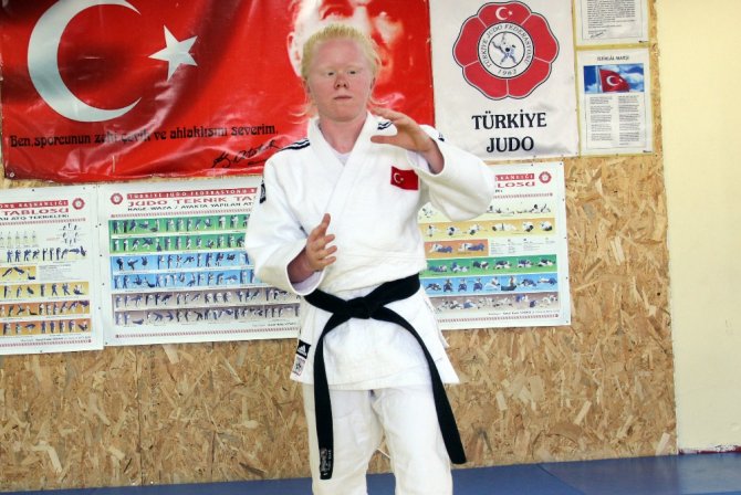 Albino Hastası Cahide’nin Hedefi Altın Madalya