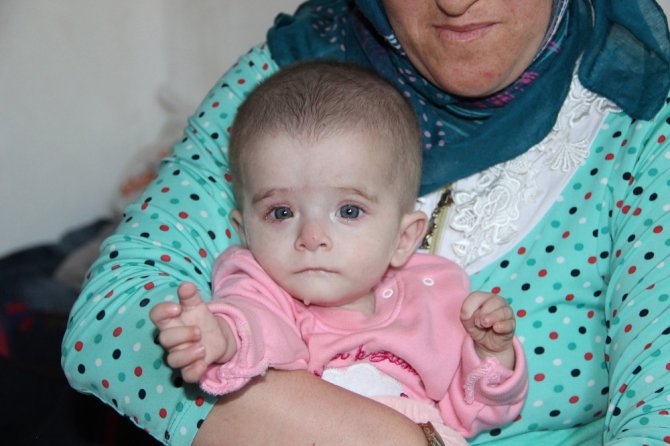 Kanser Hastası 10 Aylık Alime’nin Bakışları Yürek Yakıyor