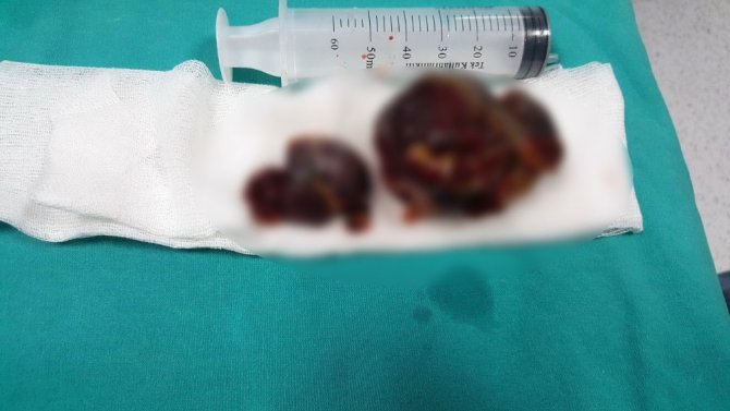 Bu Bir İnsanın Kalbinden Çıktı