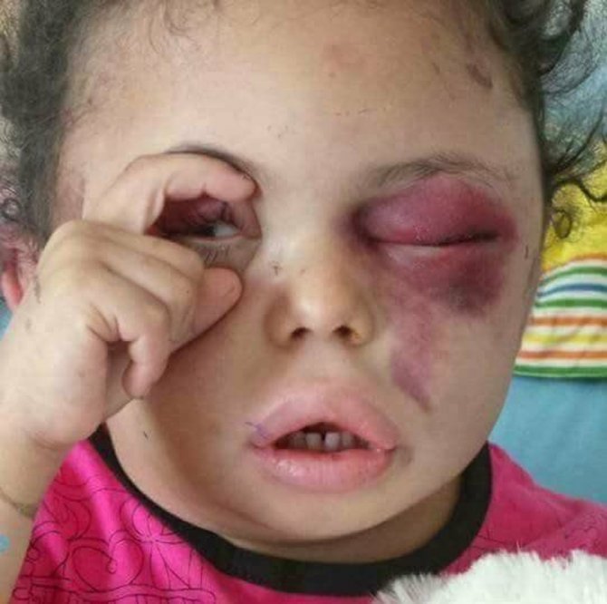 Buseyne Dünyanın Gözünü Yemen’e Çevirdi