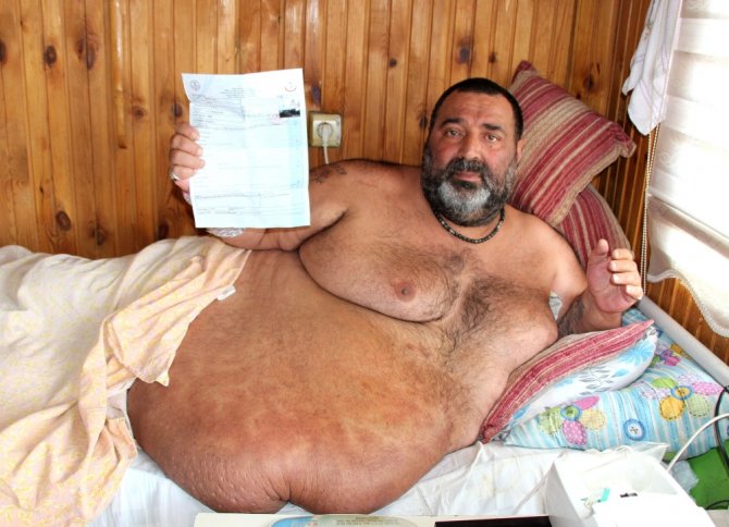 300 Kilo Ağırlığında, Yataktan Kalkamıyor