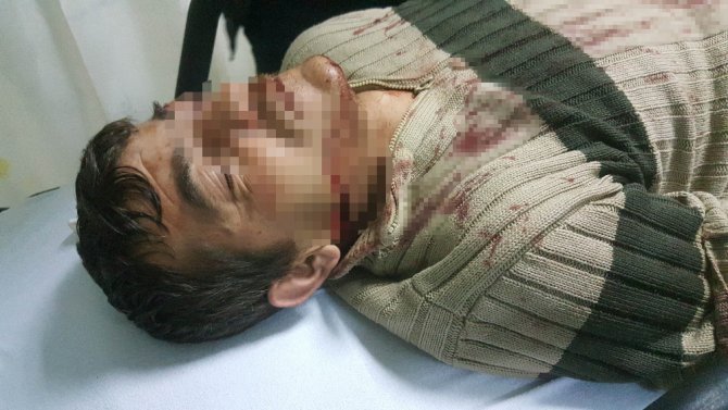 Eski Koca Dehşeti: 1’i Ağır 2 Yaralı