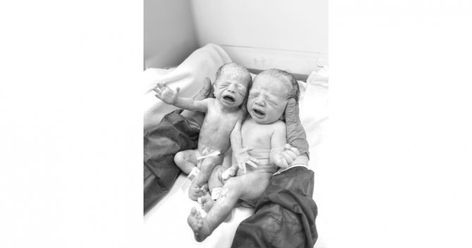 İzmir’de Tıp Tarihine Geçecek Olay 