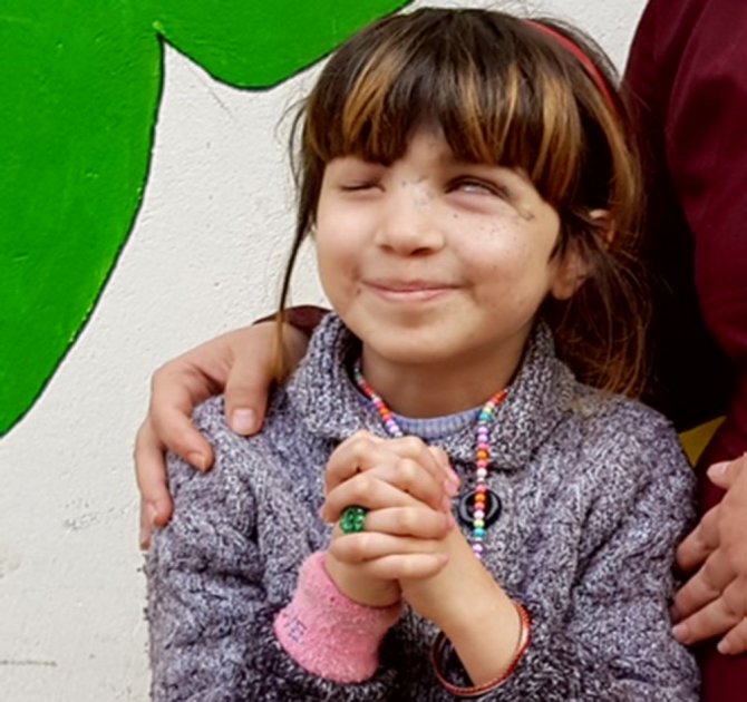 Gözünden Vurdular: Yeniden Görmesi İçin 50 Bin Tl Gerek