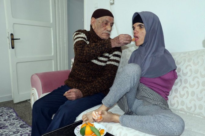 Kolsuz Hayatını Ayakları İle Aydınlattı
