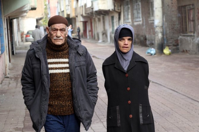 Kolsuz Hayatını Ayakları İle Aydınlattı