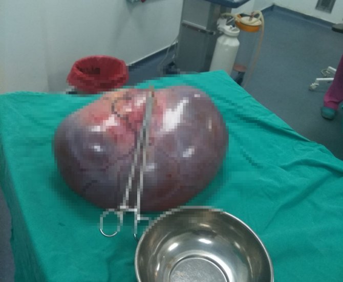 Bu Bir Kadının Karnından Çıktı