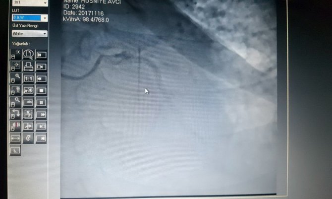 Türkiye’de İlk Kez Yaşandı !