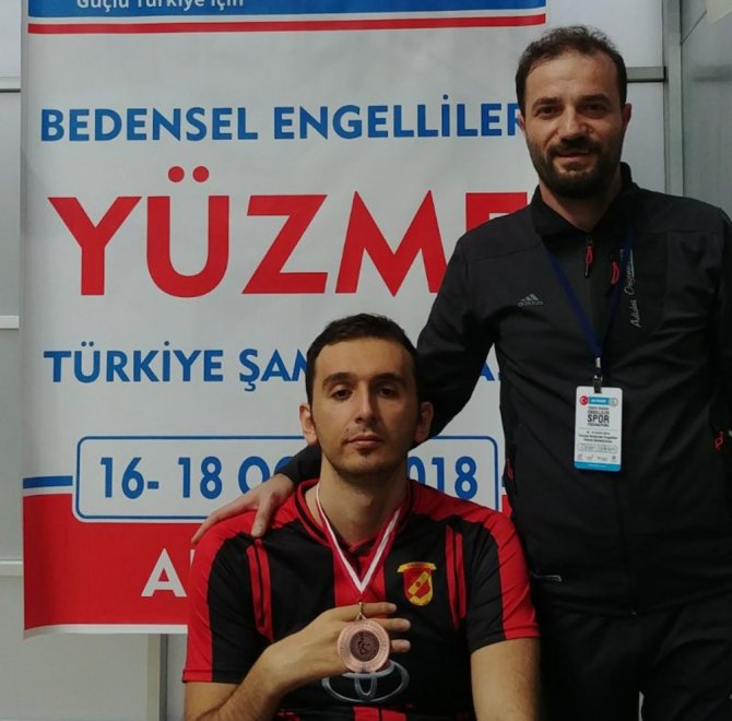 Yüzme Sevdası Yüzünden Sakat Kaldı Ama Pes Etmedi