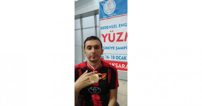 Yüzme Sevdası Yüzünden Sakat Kaldı Ama Pes Etmedi