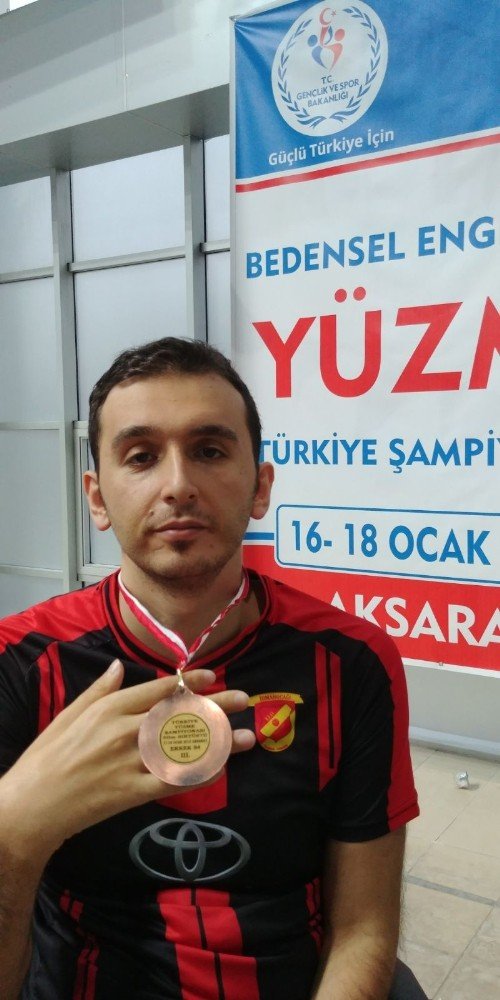 Yüzme Sevdası Yüzünden Sakat Kaldı Ama Pes Etmedi