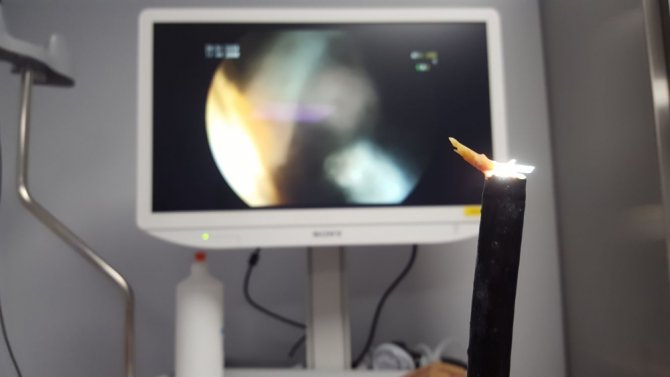 Tavuk Yerken Az Daha Ölüyordu!