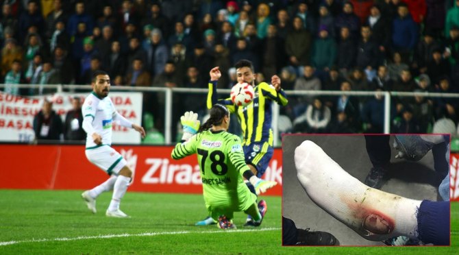 Fenerbahçe Hasan Ali Kaldırım’ın Ayağının Fotoğrafını Paylaştı