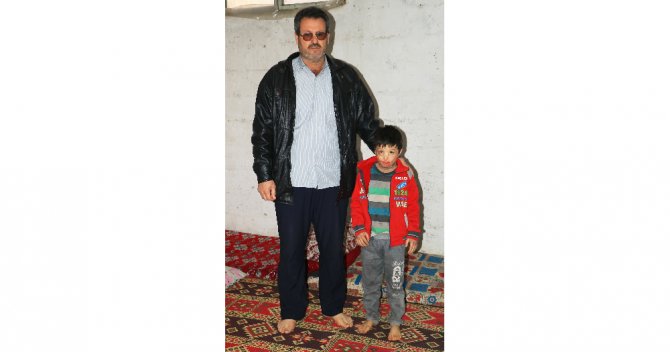 Esad’ın Varil Bombası 7 Yaşındaki Mahmud’u Yaktı