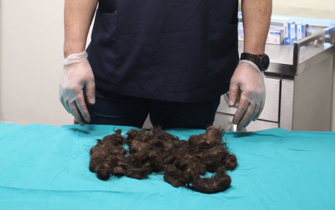 Bu Bir Kız Çocuğunun Midesinden Çıktı