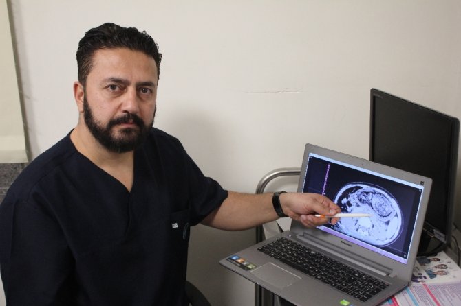 Bu Bir Kız Çocuğunun Midesinden Çıktı