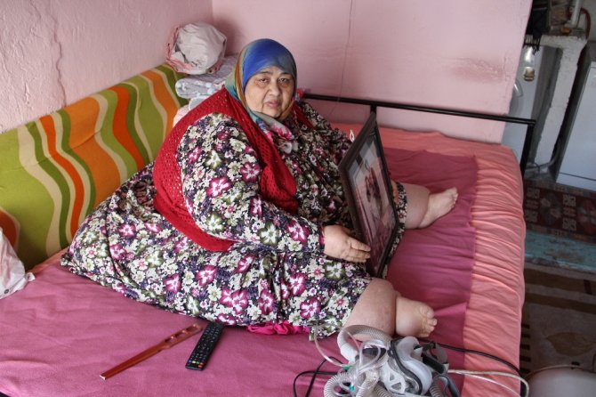 260 Kilo Ve Yatağa Mahkum