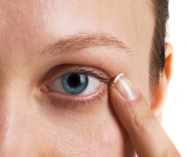 "Diyabet Hastalığı Göz Kuruluğuna Sebep Oluyor"