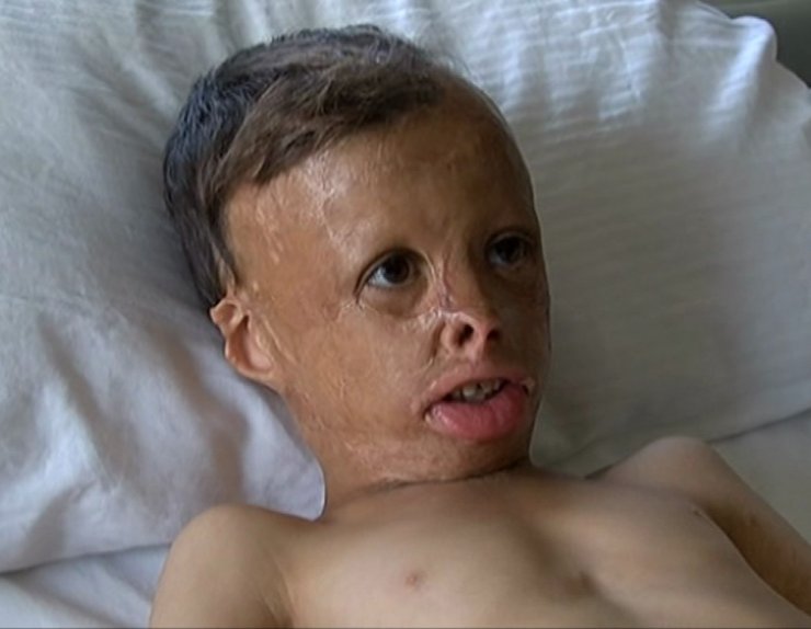 İstanbul’da Ameliyat Edildi