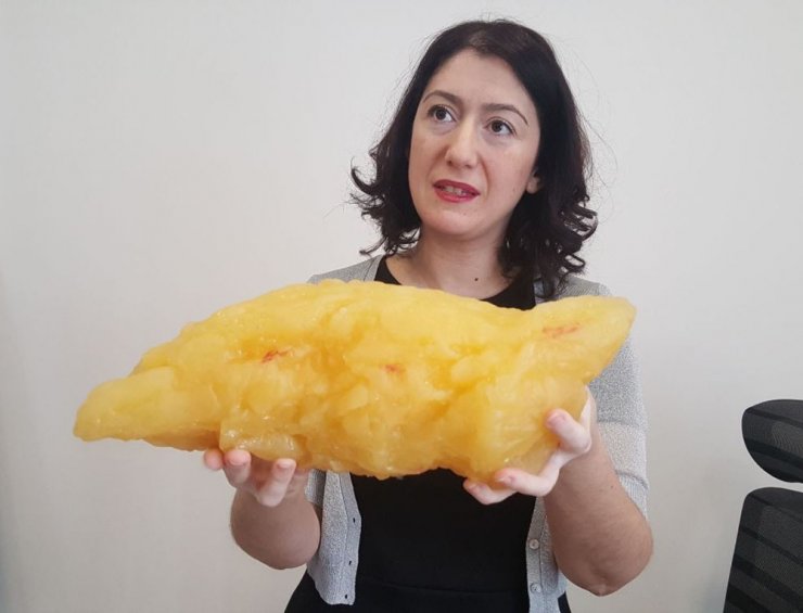 Her Sabah Poğaça Yiyorsanız Okuyun !