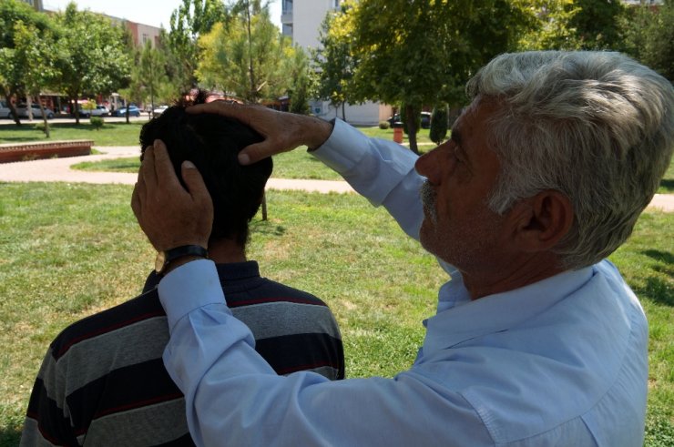 12 Yıldır Başındaki 80 Saçmayla Yaşıyor