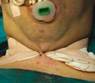 Bu Yöntem Dünyada İlk Kez Trabzon’da Uygulandı