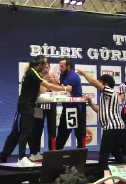 Geçirdiği Tüm Sakatlıklara Rağmen Bilek Güreşinden Kopamıyor