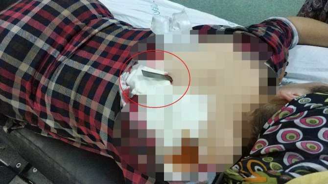 Sırtına Saplanan Bıçakla Hastaneye Kaldırıldı
