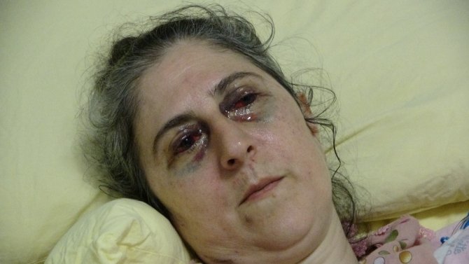 Alkollü Sürücü Anne Ve Kızını Böyle Ezdi