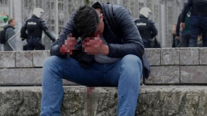 Terör Örgütü Sempatizanları, Belçika’da Gurbetçilere Saldırdı