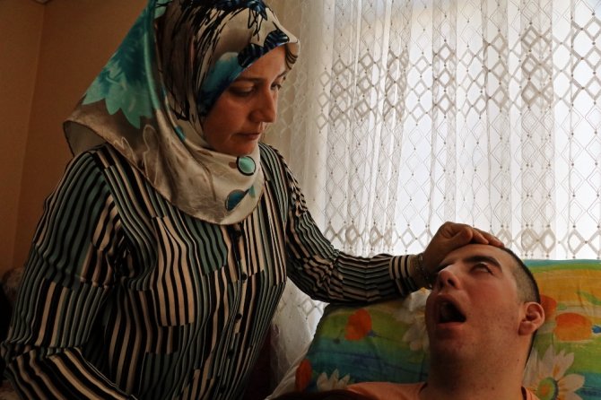 5 Yıldır Gözlerini Kırpamıyor Adeta Kan Ağlıyor