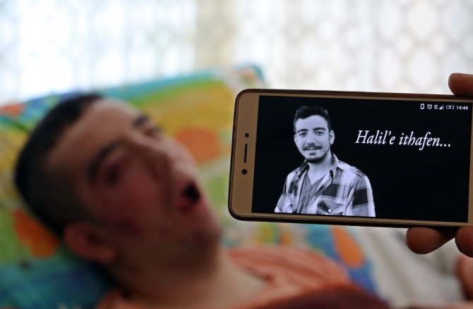 5 Yıldır Gözlerini Kırpamıyor Adeta Kan Ağlıyor