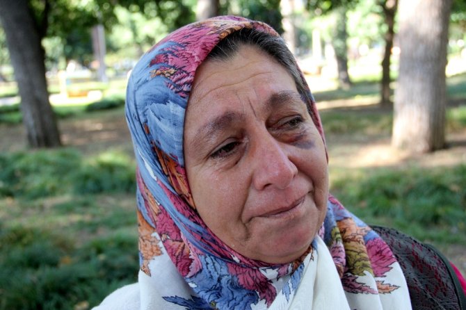 Komşu Tarafından Darp Edilen Kadın Gözyaşlarına Boğuldu