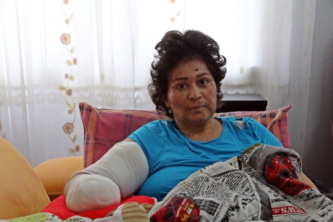 Korona Değil Güneş Eve Hapsetti