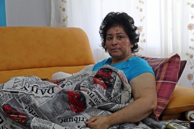 Korona Değil Güneş Eve Hapsetti