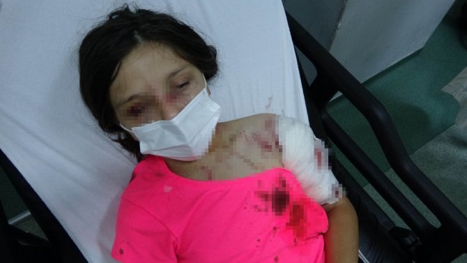 Samsun’da Pitbull Dehşeti: 11 Yaşındaki Kız Çocuğu Kanlar İçerisinde Kaldı