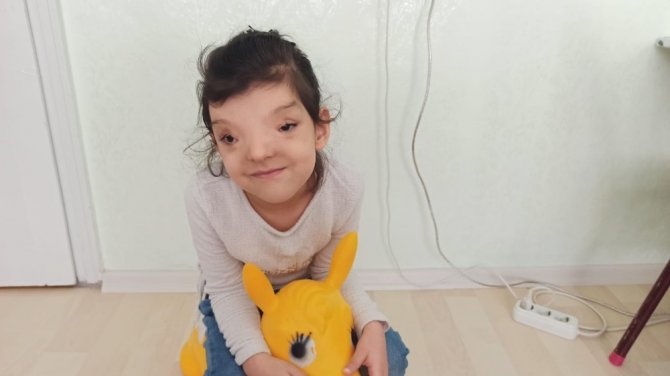 Bu Hastalık Dünyada Sadece 4 Kişide Var