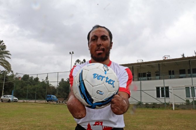 Yangında Ellerini Ve Yüzünü Kaybetti, Futbolda Gol Makinesi Oldu