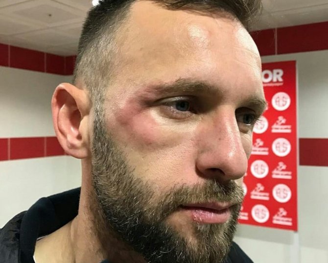 Antalyaspor’dan Sergen Yalçın’a Fotoğraflı Cevap
