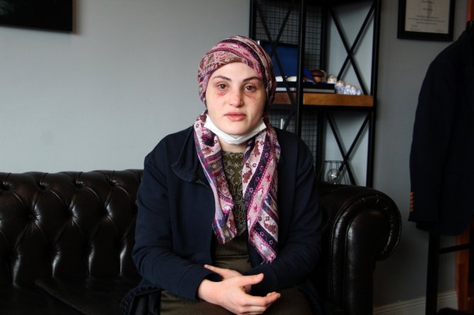 Kaçarak Evlendiği Eşi, Genç Kadına Kabusu Yaşattı