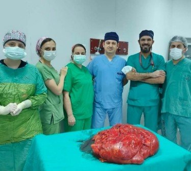 Trabzon’da Ameliyata Alınan Hastanın Karnından 21 Kiloluk Tümör Çıkartıldı
