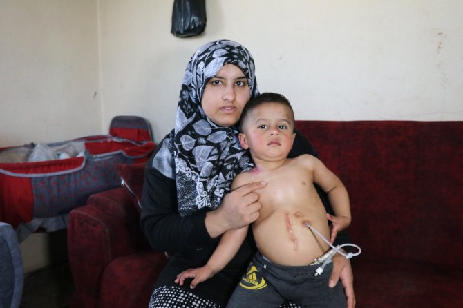 Yemek Borusu Olmayan Muhammed Yardım Bekliyor