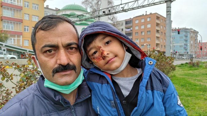 Sokak Köpeklerinin Saldırısına Uğrayan Çocuk Ölümden Kurtuldu