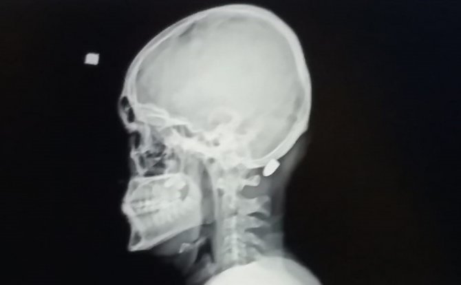 Trabzon’da Yorgun Mermilerin Failleri Bulunamıyor